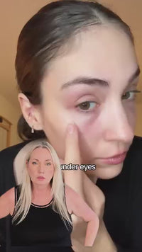 EMS Eye Beauty Device – Reduce Puffiness, Fine Lines & Boost Glow